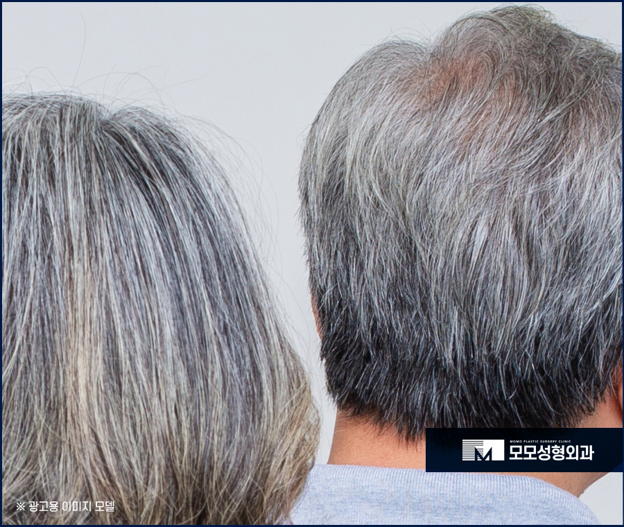 새치나는이유와 처리 방법에 대해 관련 이미지 2