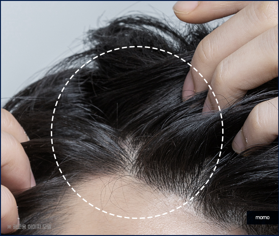 염색후 두피 가려움 원인과 완화 방법 관련 이미지 2