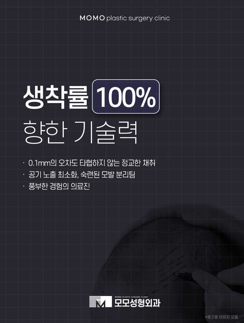 모발이식땀 나는 일은 생착률에 어떤 영향을 미칠까 관련 이미지 8