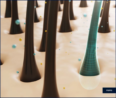 모발이식병원추천 선택 시 꼭 체크할 사항 3가지 관련 이미지 5