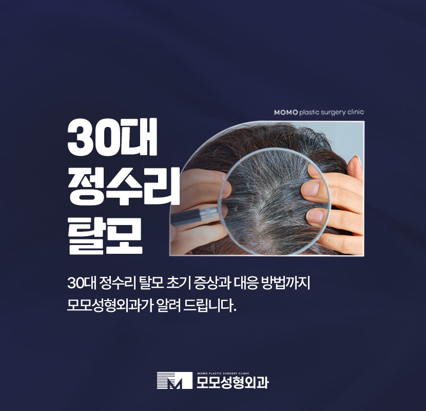 30대 정수리 탈모 초기 증상부터 대응 방법까지 관련 이미지 1