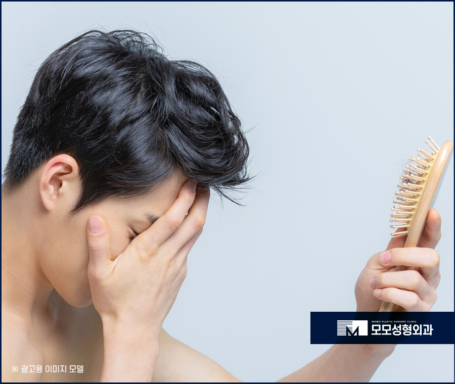 20대남성탈모 성공적인 모습을 중점으로 관련 이미지 5