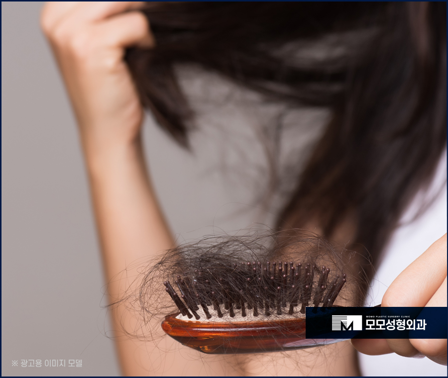 탈모전조증상 미리 알 수 있는 부분은 관련 이미지 8