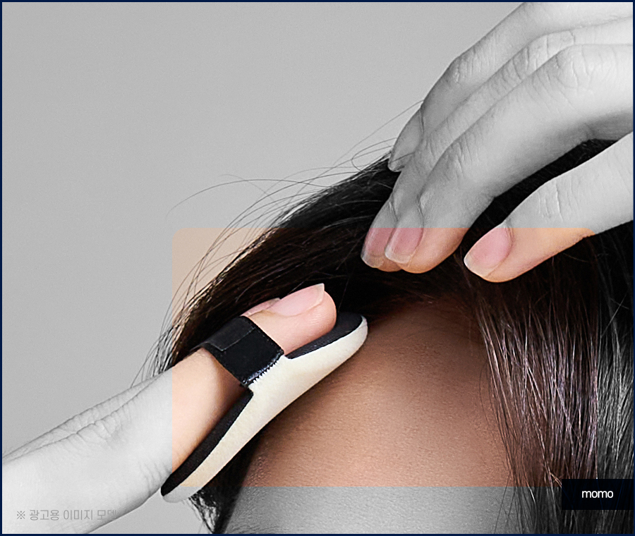 여자 M자 탈모 자연스럽게 채워가는 관련 이미지 3