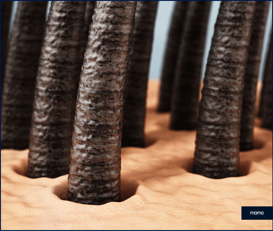 앞머리 모발이식 비용 개인에 따라 달라지는 이유 관련 이미지 11