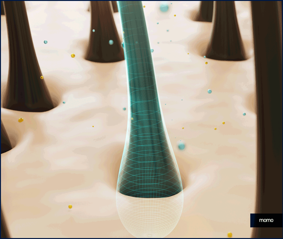 모발이식 금액 개인마다 차이가 나는 이유 관련 이미지 3