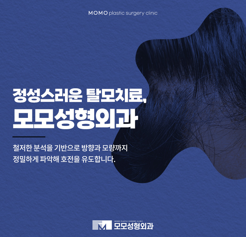 압구정탈모병원 방향과 모량까지 고려해서 관련 이미지 1