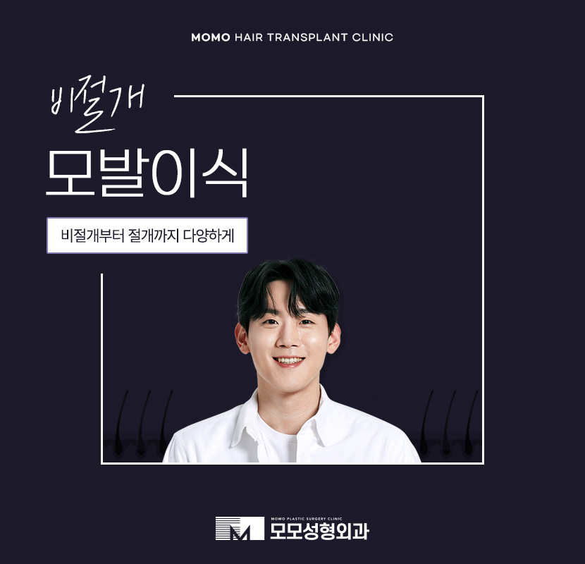 압구정탈모병원 절개가 부담스러울 경우 대안까지 관련 이미지 1