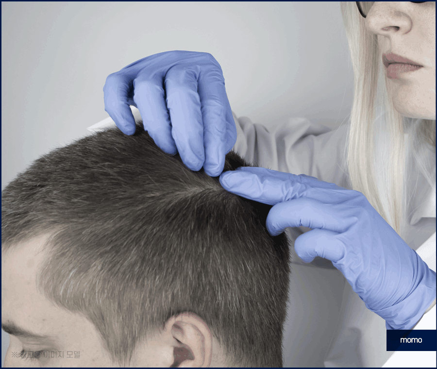 탈모약 처방 병원 꼼꼼한 진단하는 곳을 찾는다면 관련 이미지 7