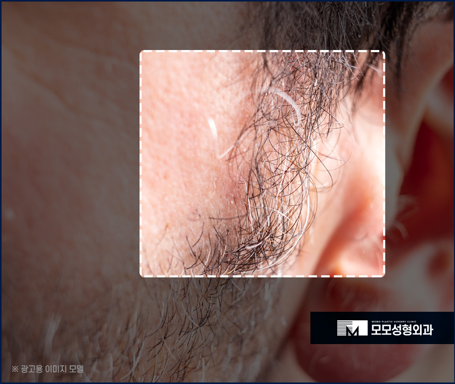 흰머리 간지러움 발생 요인부터 극복을 위해서는 관련 이미지 6