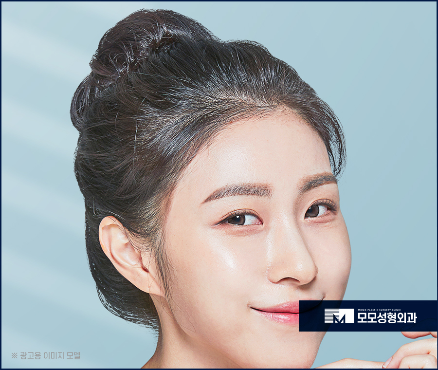 여성헤어라인교정 자연스러운 예후로 관련 이미지 7