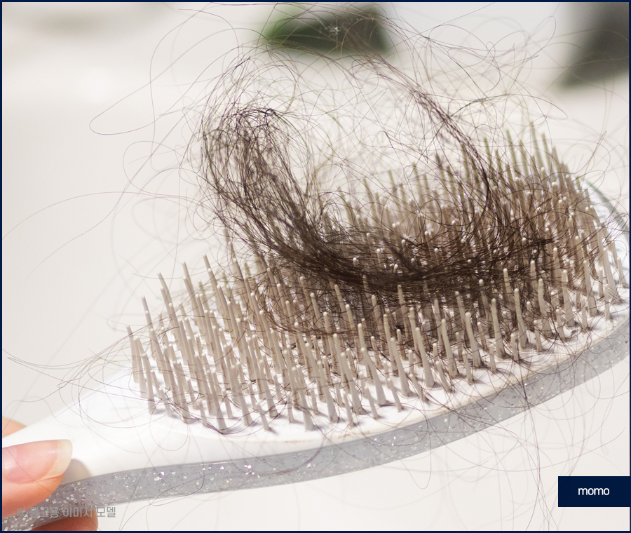비절개 모발이식 비용 개인차를 고려해서 관련 이미지 2