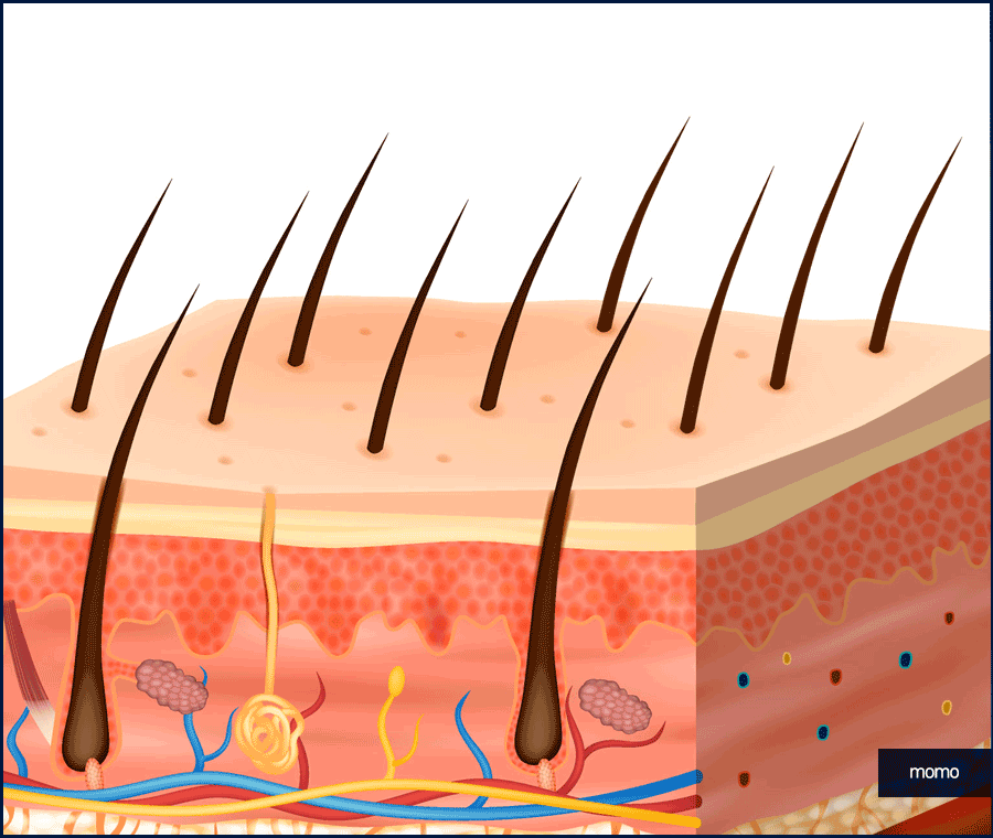 머리심기 비용 및 시술별 장단점 알아보기 관련 이미지 10
