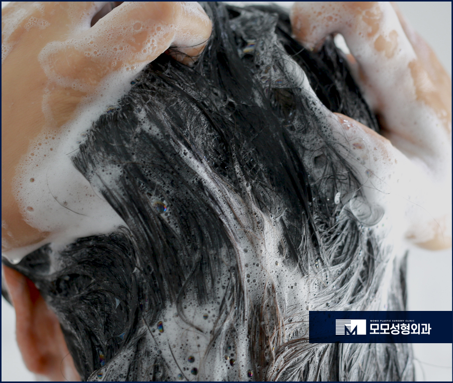 두피 피지낭종으로 인해 발생할 수 있는 문제들 관련 이미지 8