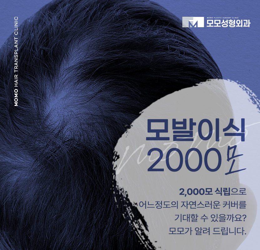 모발이식 2000모 자연스러운 커버 결과 정도는? 관련 이미지 1