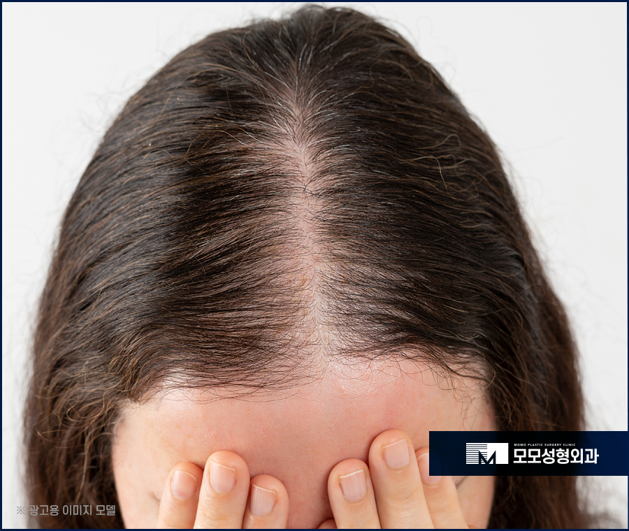 바르는탈모약 효과를 톡톡히 보길 원한다면 관련 이미지 2