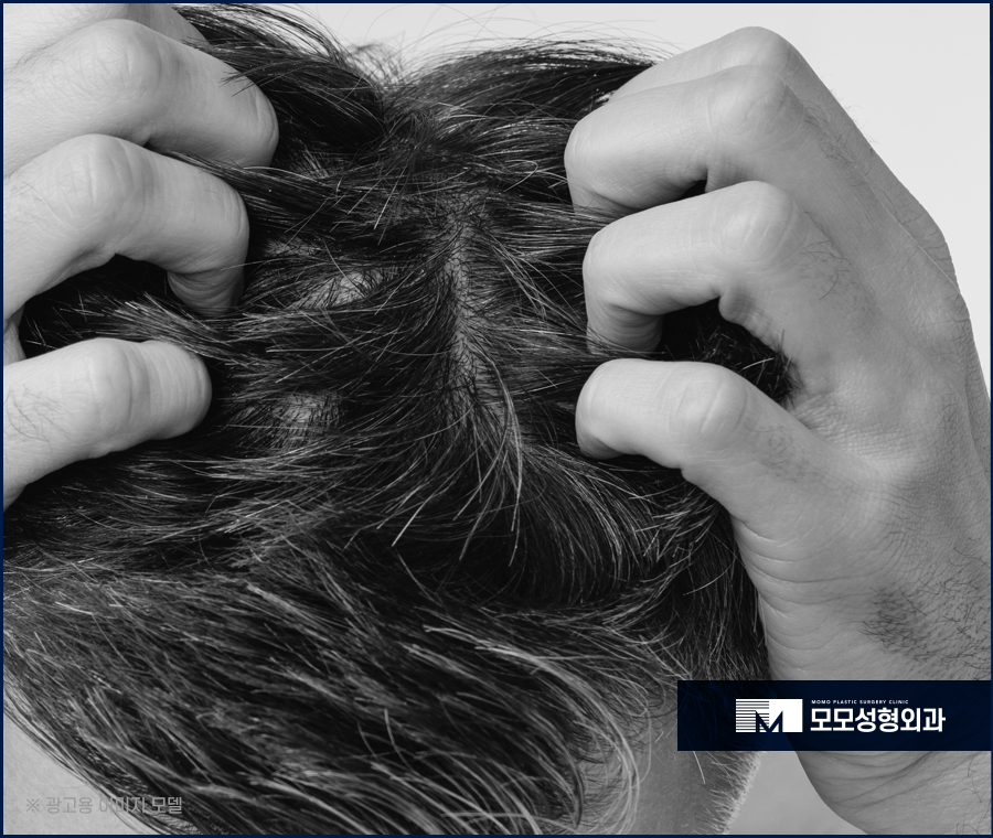 비절개모발이식가격 꼼꼼히 살펴보며 함께 체크할 점 관련 이미지 2