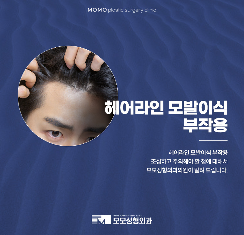 헤어라인모발이식부작용 조심하고 주의해야 할 점은 관련 이미지 1