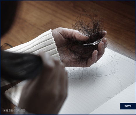 20대 원형탈모 효과적인 개선 방법은 관련 이미지 3