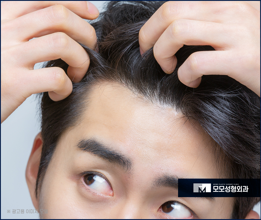 엠자탈모 초기 어떤 증상들이 동반될까요 관련 이미지 5