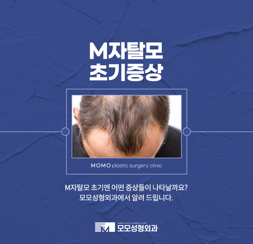 m자탈모초기증상 면밀하게 관찰해야 하는 이유 관련 이미지 1