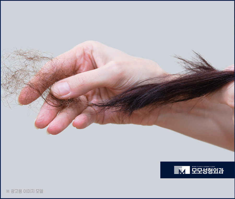 여자M자탈모 외모의 퀄리티를 더하는 보강 방법 관련 이미지 3