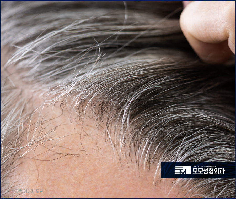 새치염색주기 무리를 주지 않는 선은 관련 이미지 3