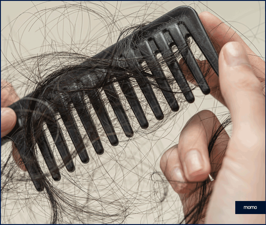 모발이식 생착기간 섬세한 관리가 필요한 이유 관련 이미지 4