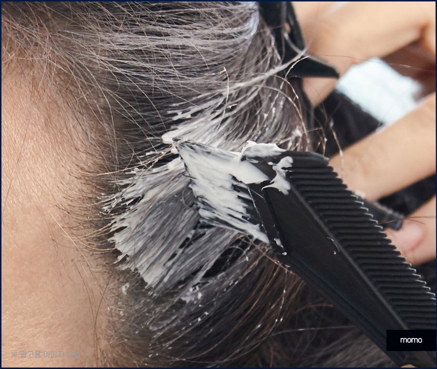 모발이식 후 염색 언제쯤 하는게 좋을까요 관련 이미지 7
