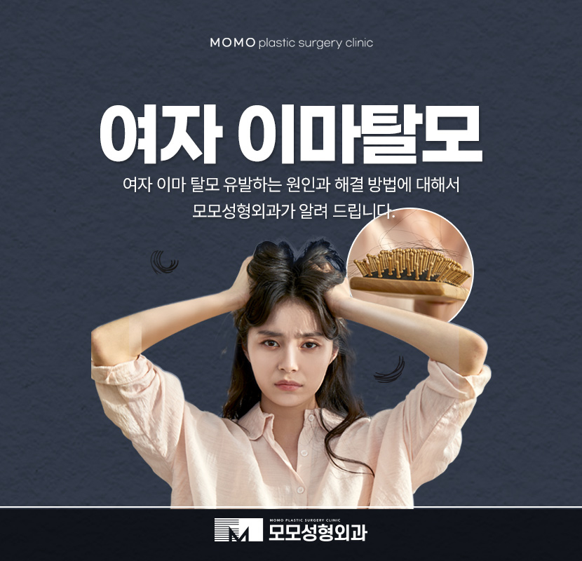 여자이마탈모 유발하는 원인과 개선 방법까지 관련 이미지 1