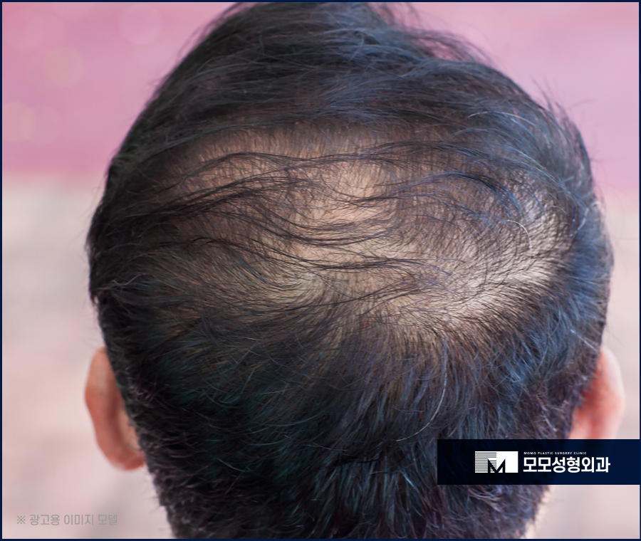 두피마사지법 증세에 효과적인 관련 이미지 2