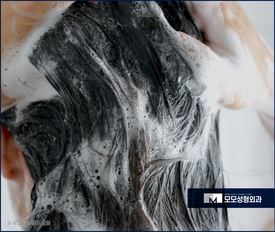 머리안감으면탈모 증상이 찾아올까요 진실은 관련 이미지 7