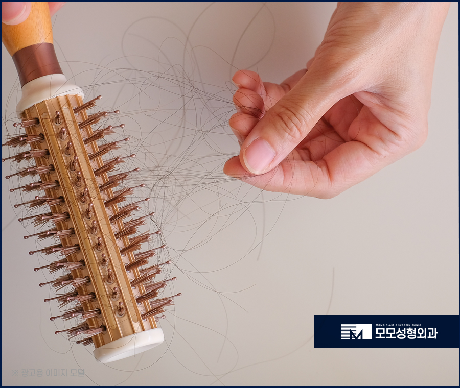 모발이식가격 산정되는 기준에 대해서 관련 이미지 3