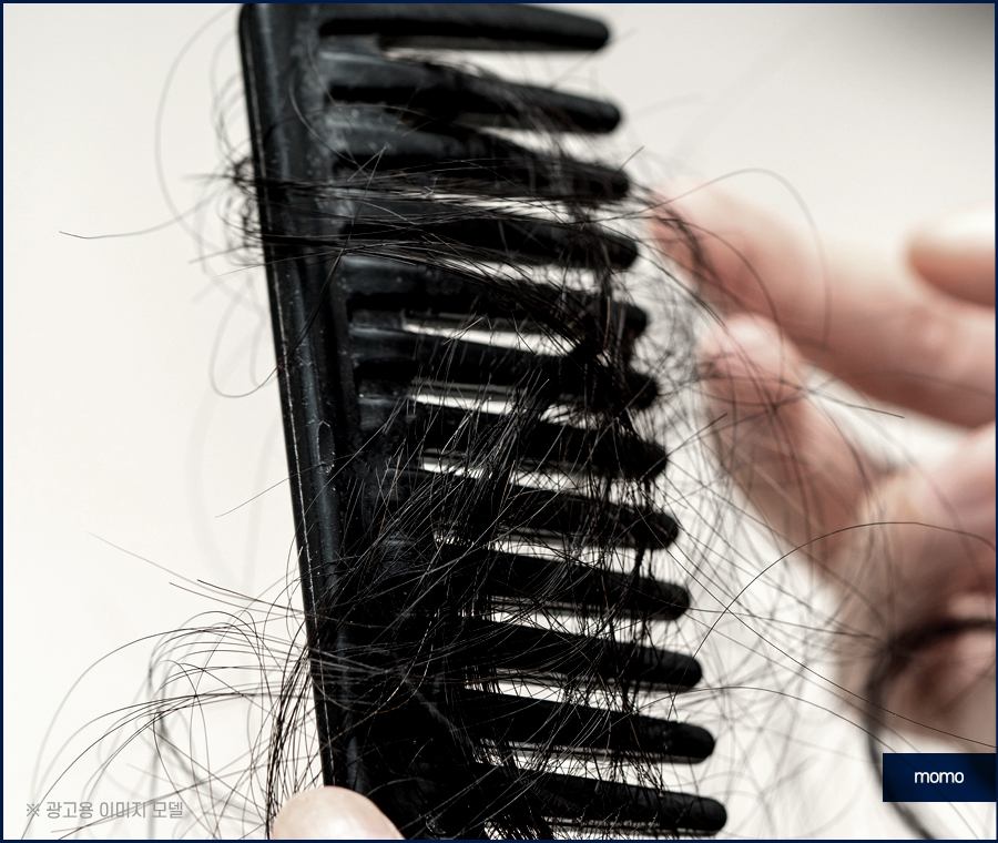 남자 헤어라인 교정 불규칙한 라인 보완을 위해 관련 이미지 3