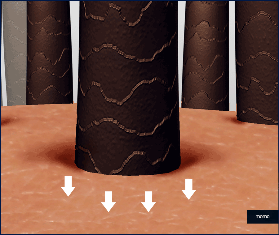 남자 모발이식 비용, 방법까지 꼼꼼히 확인하세요! 관련 이미지 7
