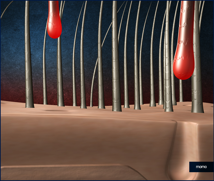 남자 가르마 탈모 진짜 내 머리처럼 채우려면 관련 이미지 8