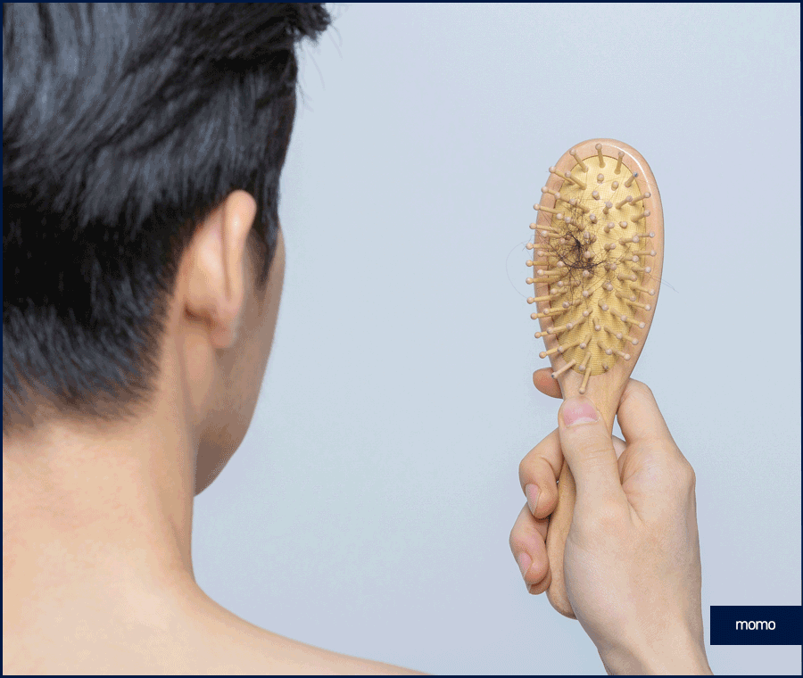 비절개모발이식가격 확인보다 중요한 점 관련 이미지 3