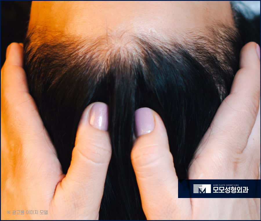 겨울철 두피관리 건강한 상태를 유지하기 위해 지켜주세요 관련 이미지 6