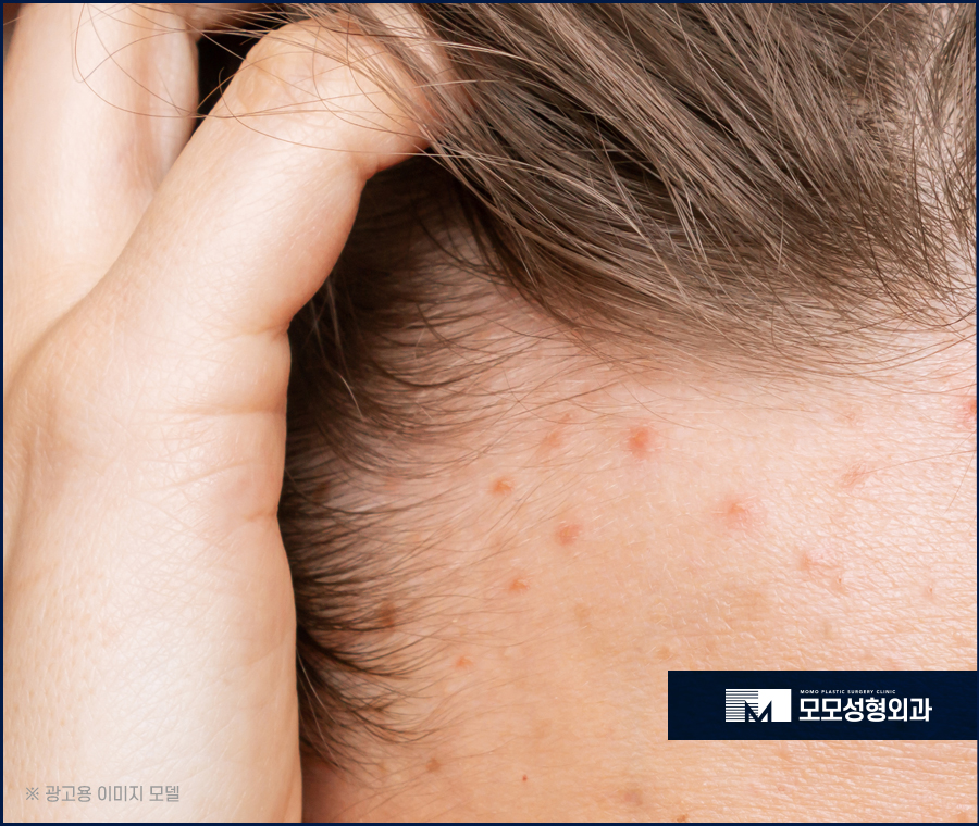 여자엠자탈모 인상까지 변화될 수 있도록 관련 이미지 3