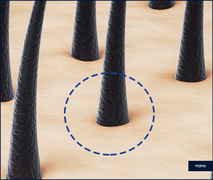 남자 탈모약으로 치료할 때 확인할 사항 관련 이미지 2