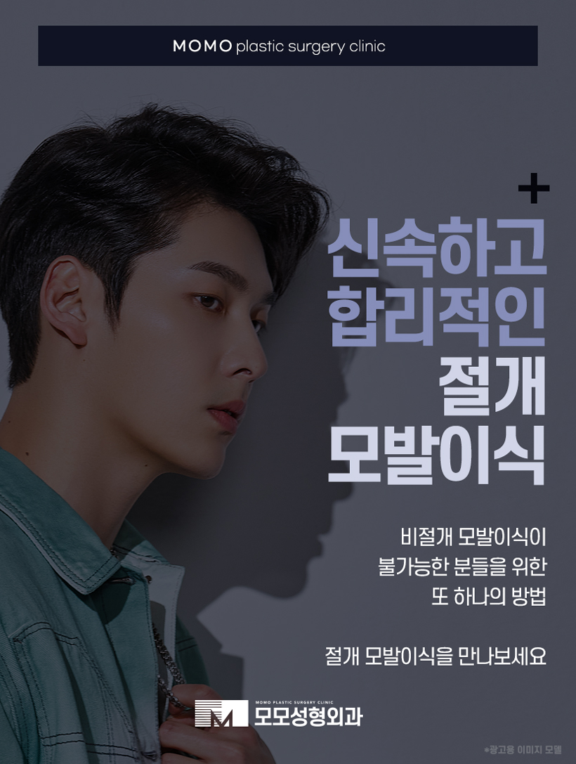 정수리탈모치료비용 모발이식을 기준으로 했을 땐 관련 이미지 5