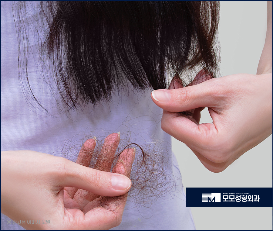여자비절개모발이식 이질감없는 자연스러움으로 관련 이미지 4