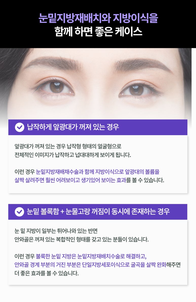 To Achieve Satisfactory Results from Lower Eyelid Fat Repositioning Surgery image 3