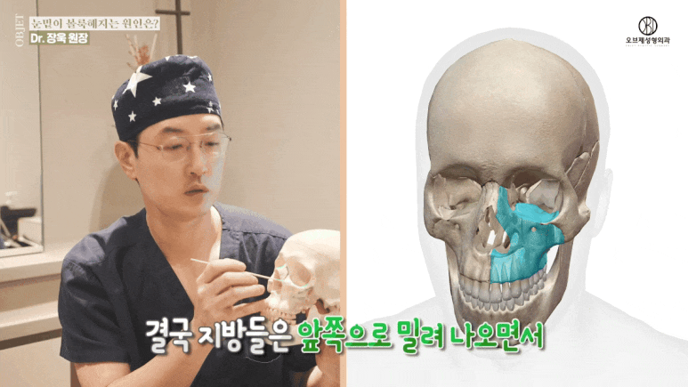 눈밑지방재배치 유지기간 성형외과 의사가 밝히는 2가지 진실! 관련 이미지 6