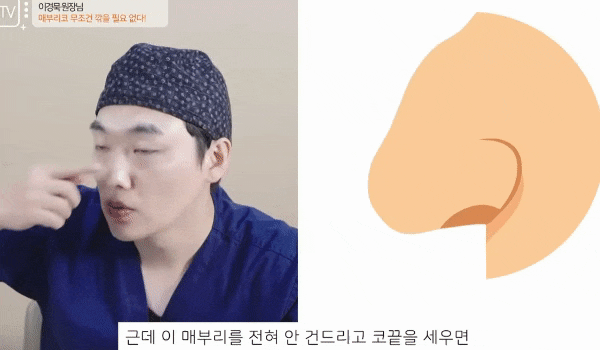 Is Osteotomy Essential for Hump Nose Surgery? Dr. Lee Kyung-mook Clears Up the Misunderstanding! image 5