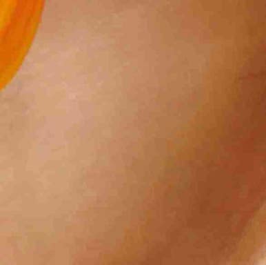 Various Types of Gangnam Thread Lifting image 16