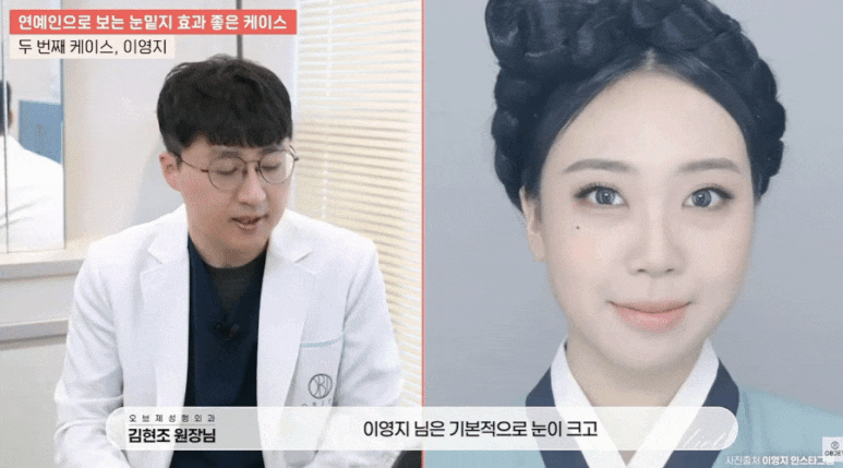 눈밑지 병원? 관련 이미지 9