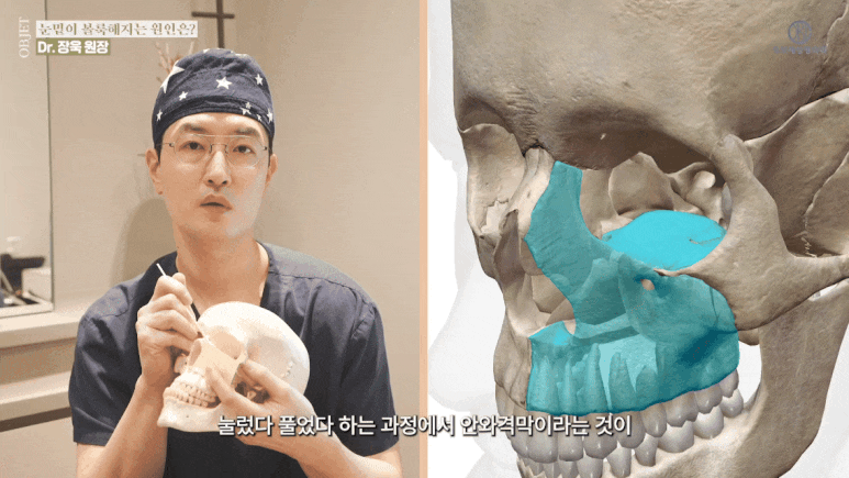 눈밑지방재배치 유지기간 성형외과 의사가 밝히는 2가지 진실! 관련 이미지 8