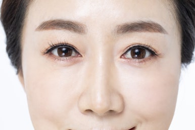 Best Place for Lower Blepharoplasty in Gangnam POINT image 17