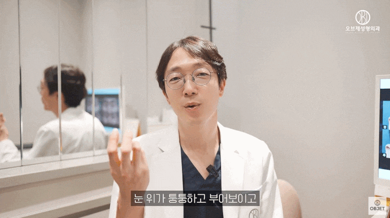 Before-and-After Double Eyelid Surgery? Are There Eyes That Suit Double Eyelid Surgery Better? (Explained by a Board-Certified Plastic Surgeon) image 5